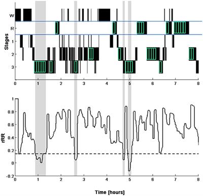Reproducibility of Heart Rate Variability Is Parameter and Sleep Stage Dependent